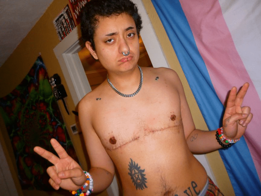 DAVID WITH HIS TOP SURGERY